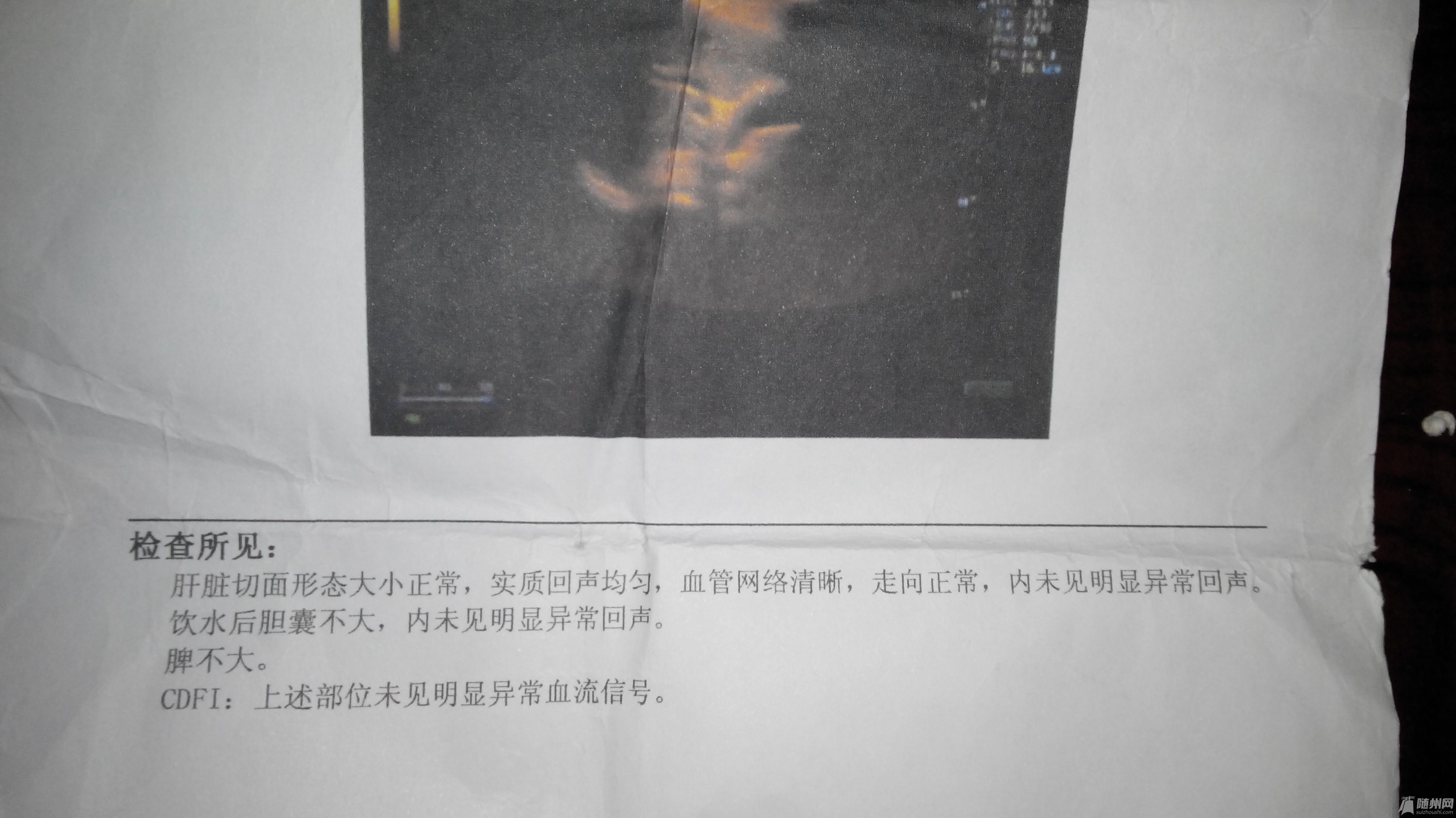 2014111100456.jpg