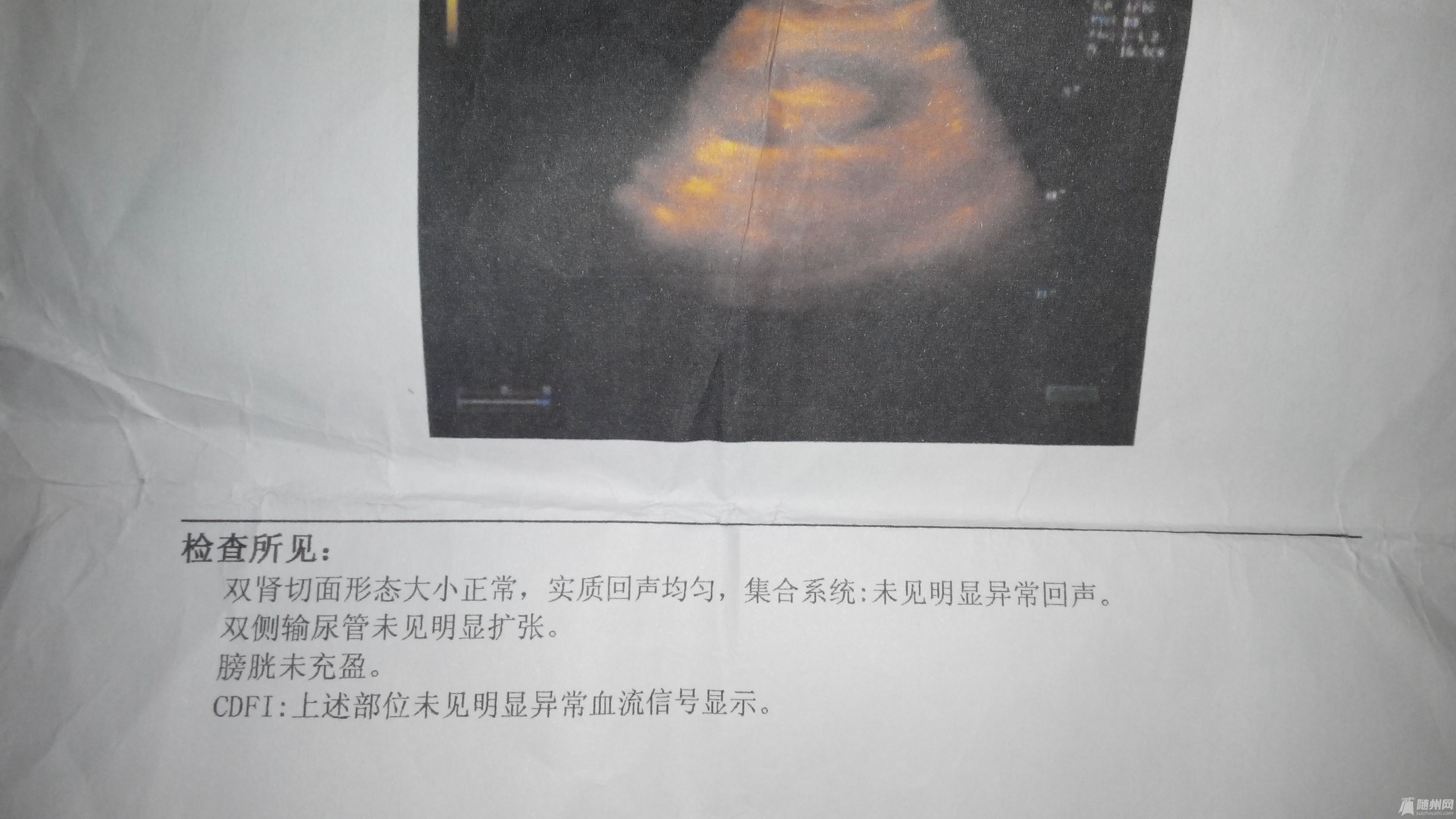 2014111100508.jpg