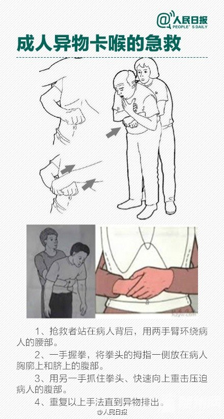 ￨ô
