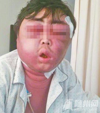 7月28日三分钟新闻①万和乡村公路惊现一枚炮