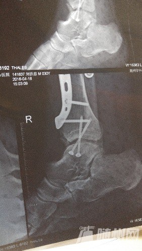 20160424_205744.jpg