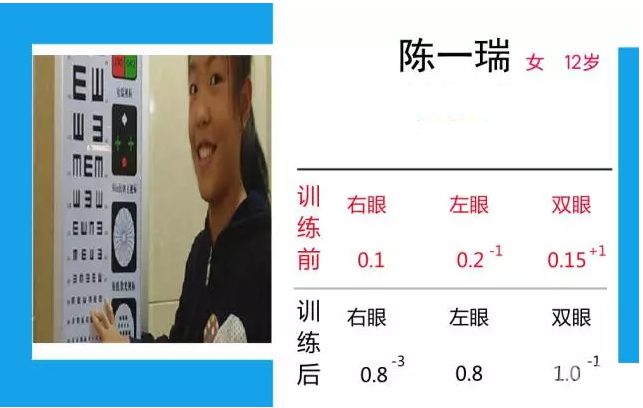 QQͼ20170718101544.png